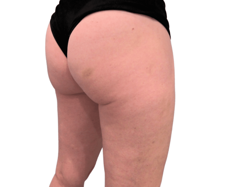 After Image: Morpheus Butt & Thighs - right-back-oblique