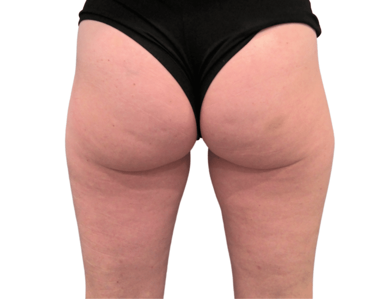After Image: Morpheus Butt & Thighs - back
