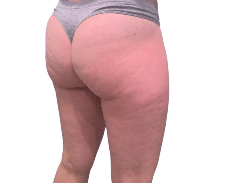 Before Image: Morpheus Butt & Thighs - right-back-oblique