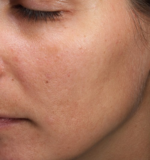 Before Image: Moxi - left-front-oblique