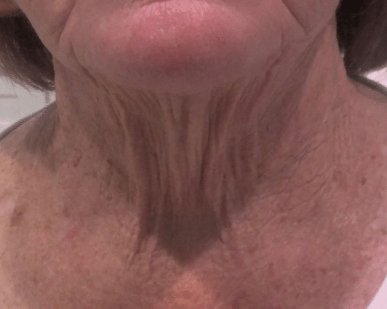 After Image: Morpheus Neck - front