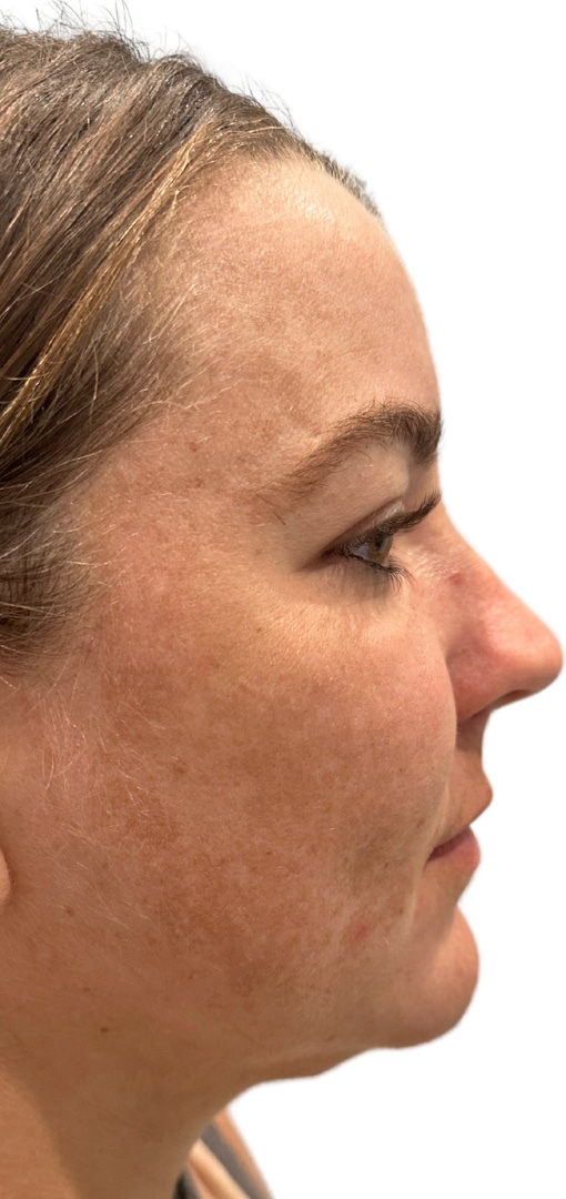 Before Image: Moxi - right-side