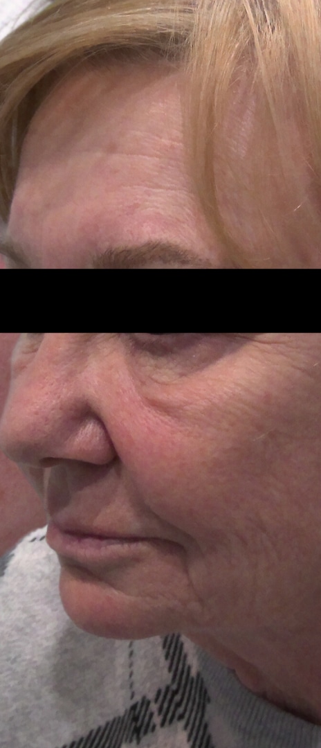 After Image: BroadBand Light - left-front-oblique